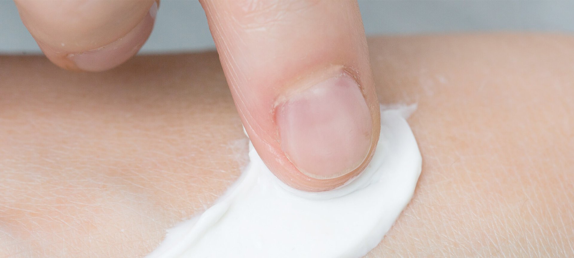 舒緩敏感肌的5項保養建議（標題）