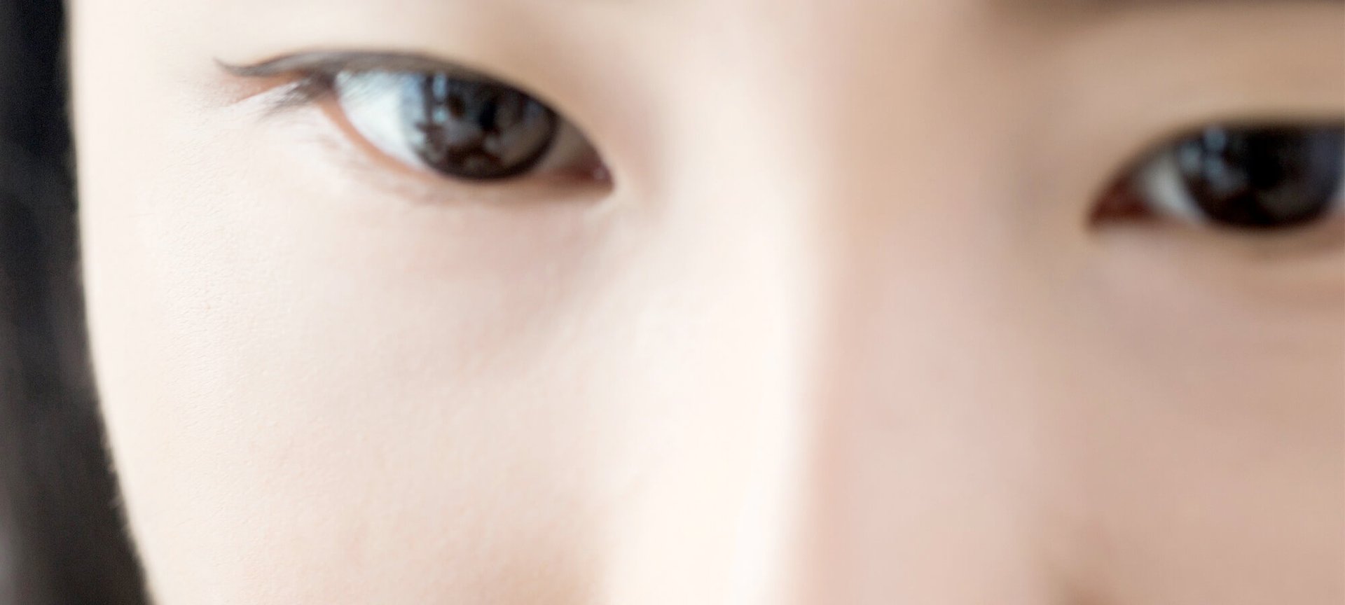 一勞永逸消除黑頭粉刺（文章）