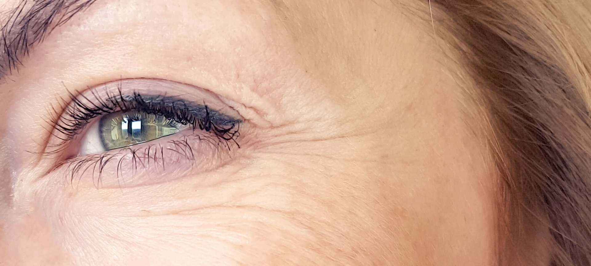 我的眼睛下面出現豎紋！（文章）