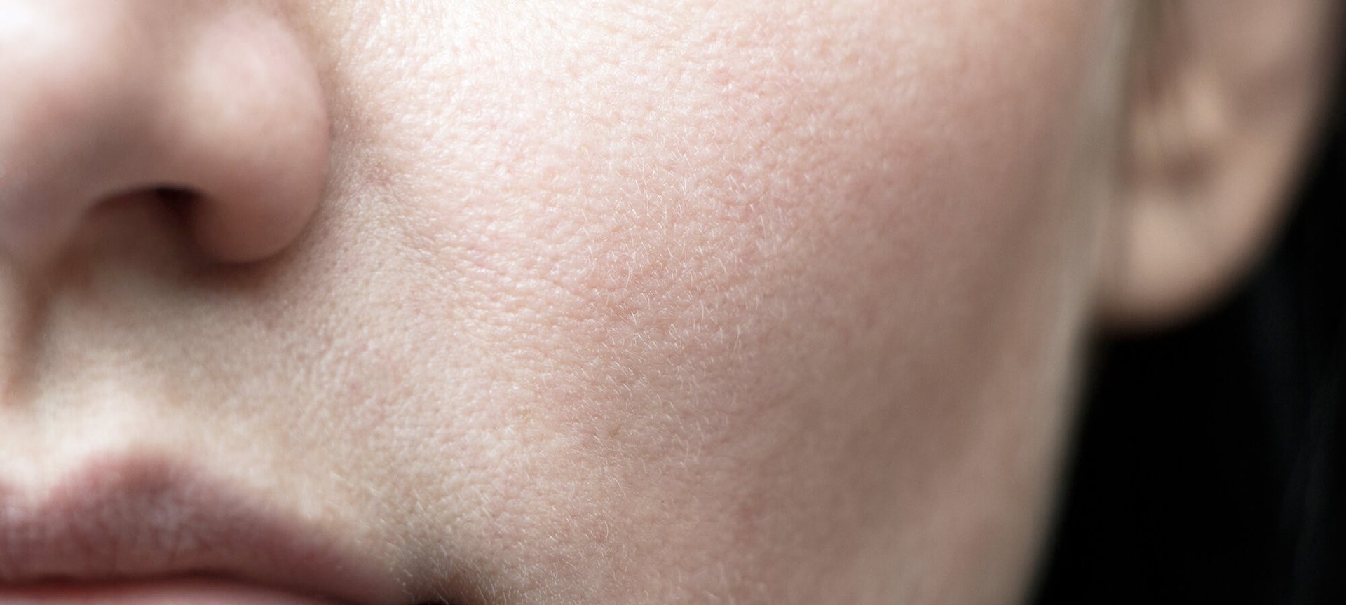 甘醇酸的五大美膚功效（文章）