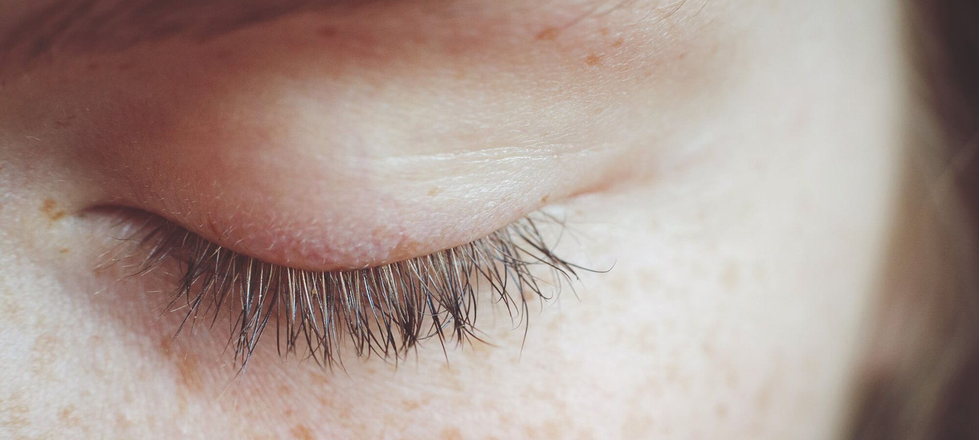 最佳眼部護理，讓您重煥青春光采（標題）