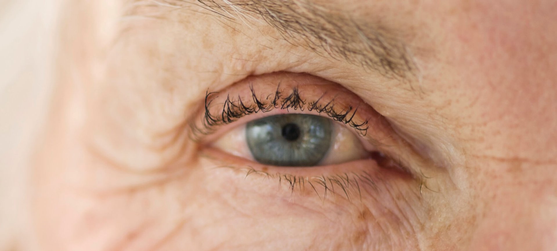 採用光照治療抗皺（標題）